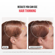 Premium Collagen Complex