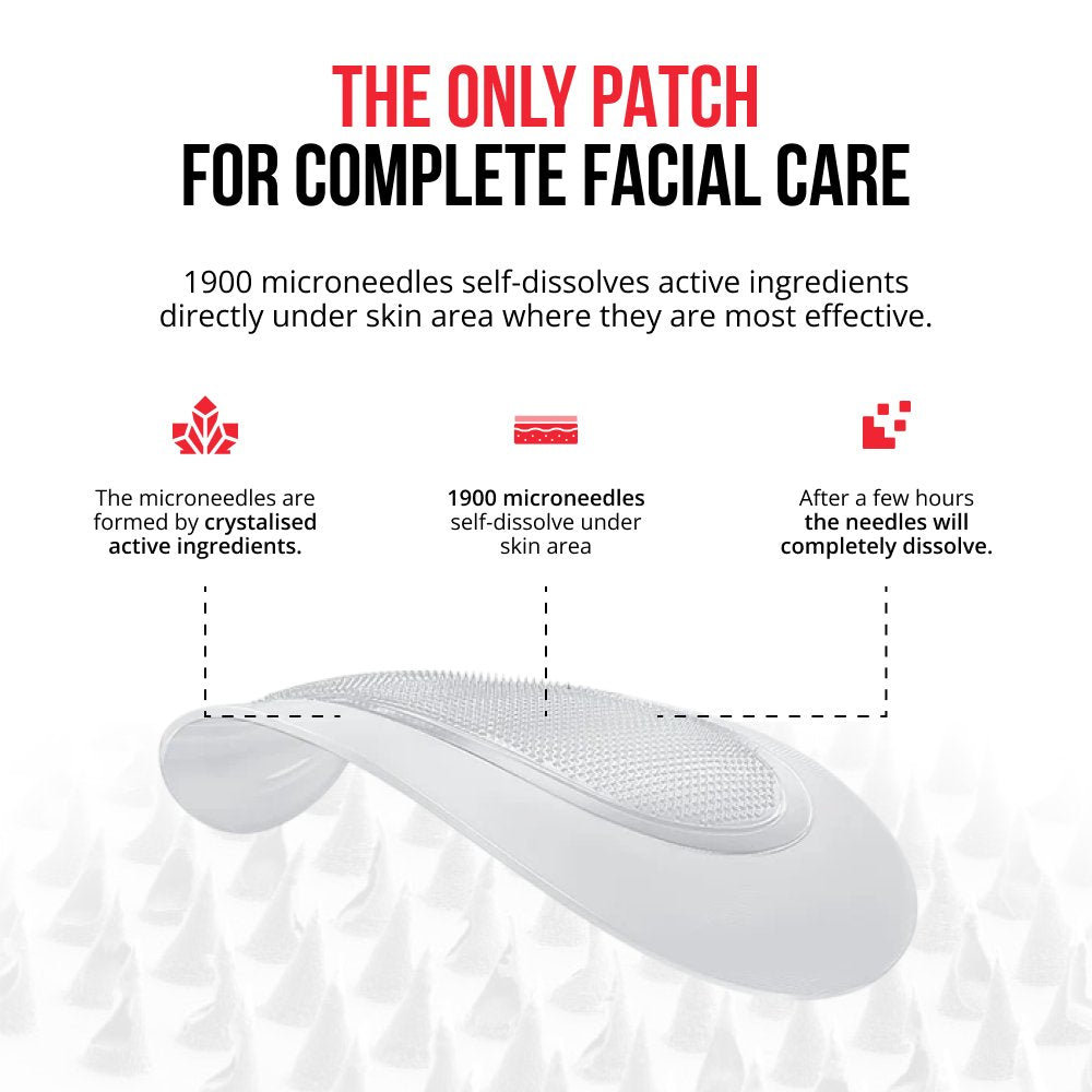 Self-dissolving Microneedle Patches