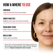 Self-dissolving Microneedle Patches