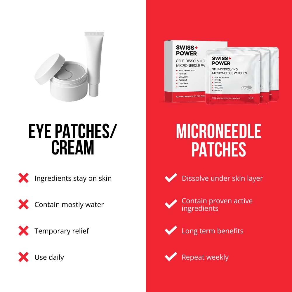Self-dissolving Microneedle Patches
